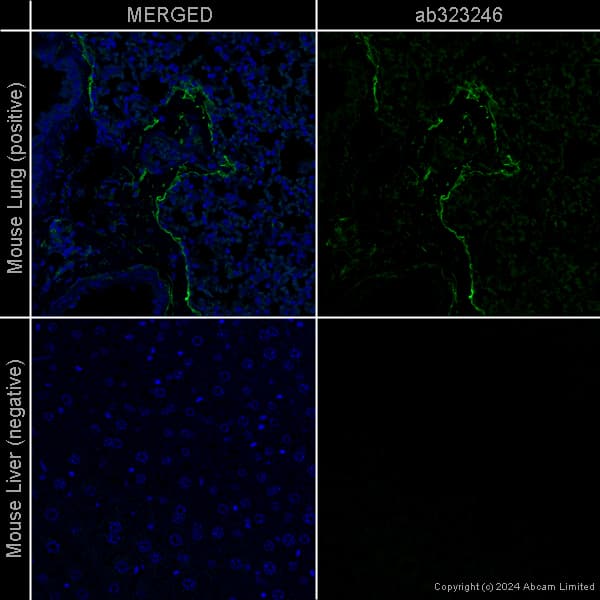 Rabbit Monoclonal H26 10 Human Igg1 H L Alexa Fluor 488 Ab200622  Immunohistochemistry Formalin Pfa Fixed Paraffin Embedded Sections Img440860