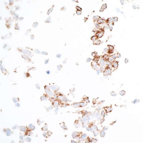 Anti-PDGFR beta antibody [BLR081G] - BSA free(AB314096)