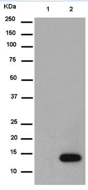 Anti-Prostaglandin E Synthase/MPGES-1 antibody [EPR13765](AB180589)