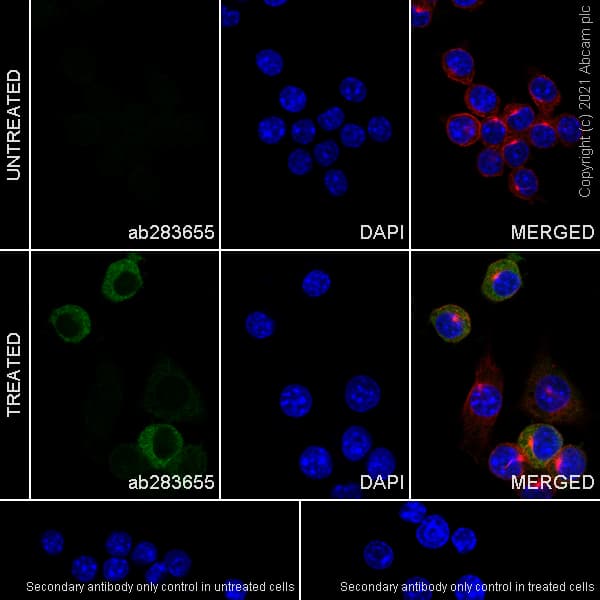 Anti-iNOS antibody [RM1017](AB283655)