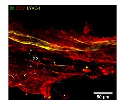 Anti-LYVE1 antibody - BSA and Azide free(AB14917)