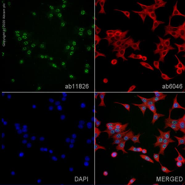 Anti-SC35 antibody [SC-35] - Nuclear Speckle Marker(AB11826)