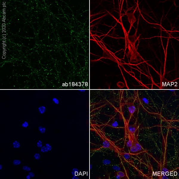 Anti-Neurofascin antibody [EPR19004] - BSA and Azide free(AB250747)
