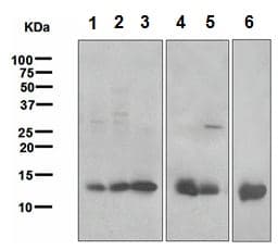 Galectin 1 Antibody Epr3205 Bsa And Azide Free Ab271876  Western Blot Img77477