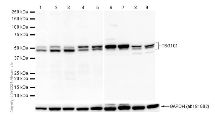 Anti-TSG101 antibody [EPR7130(B)](AB125011)