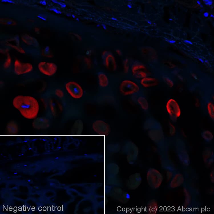 Alexa Fluor® 647 Anti-Aggrecan antibody [6-B-4](ab315140)