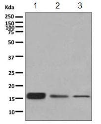 Rps19 Antibody Epr10422 Bsa And Azide Free Ab249237  Western Blot Img106357