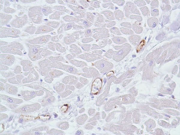 Anti-CD31 antibody [SP38](AB231436)