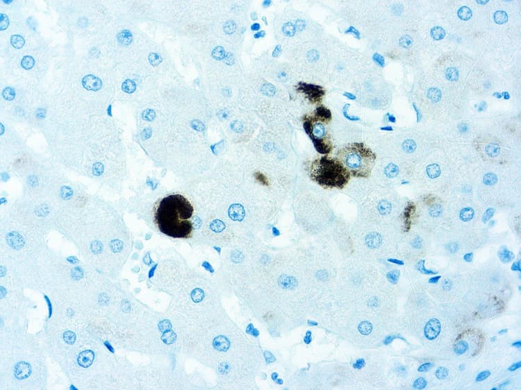 Anti-Hepatitis B Surface Antigen antibody [5C3](AB277481)