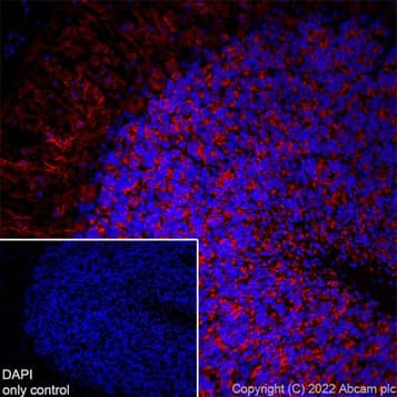Alexa Fluor® 647 Anti-MAP2 antibody [EPR19691](AB225315)