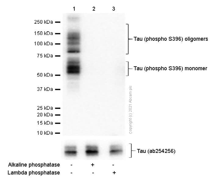 Anti-Tau (phospho S396) antibody [EPR2731](AB109390)