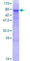 Recombinant Human PNPLA3 protein(AB132787)