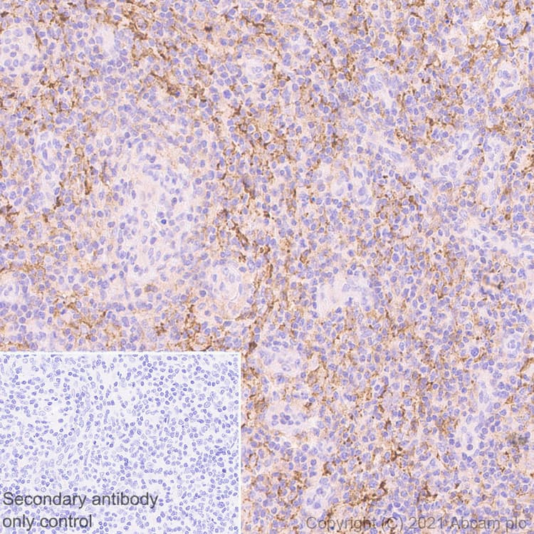 Ly75 Dec 205 Antibody Epr5233 Ab124897  Immunohistochemistry Formalin Pfa Fixed Paraffin Embedded Sections Img168669