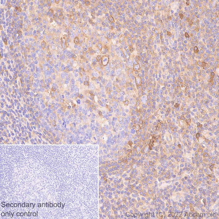 Anti-HLA-C antibody [EPR26121-73](AB307361)