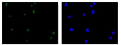 Baf53b Antibody Ep10101 Ab180927  Immunocytochemistry Immunofluorescence Img70687