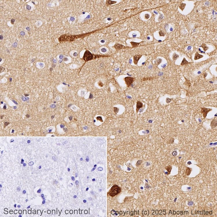 Anti-PSD95 antibody [EPR23124-118] - Synaptic Marker(AB238135)
