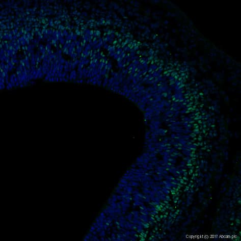 Anti-TBR2 / Eomes antibody(AB23345)