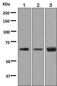 Anti-BTBD17 antibody [EPR9593(B)](AB138507)