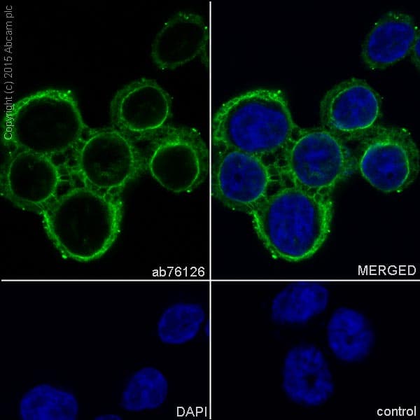 Anti-Cytokeratin 20 antibody [EPR1622Y] - BSA and Azide free(AB219589)