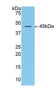 Anti-alpha 1 Antitrypsin antibody(AB231093)