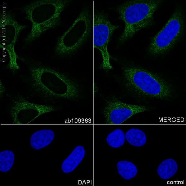 Anti-RENT1/hUPF1 antibody [EPR4681](AB109363)