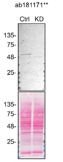 Anti-HNRPH2/HNRNPH2 antibody [EPR12171] - BSA and Azide free(ab250397)