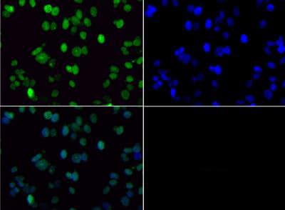Histone H3 Di Methyl K36 Antibody Ab272158  Immunocytochemistry Immunofluorescence Img106251
