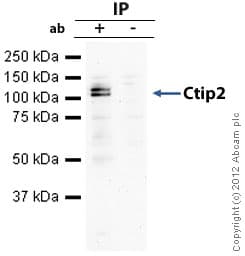 Anti-Ctip2 antibody(AB28448)