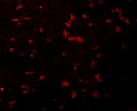 Anti-RIP Antibody ab106393 Polyclonal Antibodies | Danaher Life Sciences
