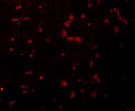 Anti-RIP antibody(AB106393)