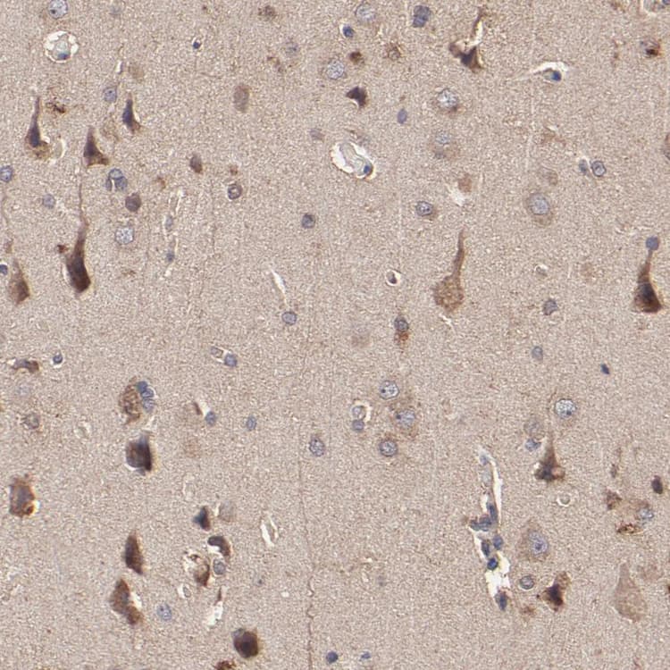 Ston2 Antibody Ab121165  Immunohistochemistry Formalin Pfa Fixed Paraffin Embedded Sections Img54171