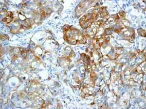 Anti-MUC1 antibody [EPR1023](AB109185)