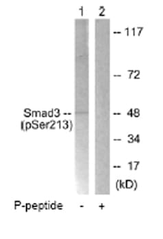 Smad3 Phospho S213 Antibody Ab63403  Western Blot Img8807