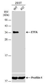 Etfa Antibody Ab153722  Western Blot Img449734