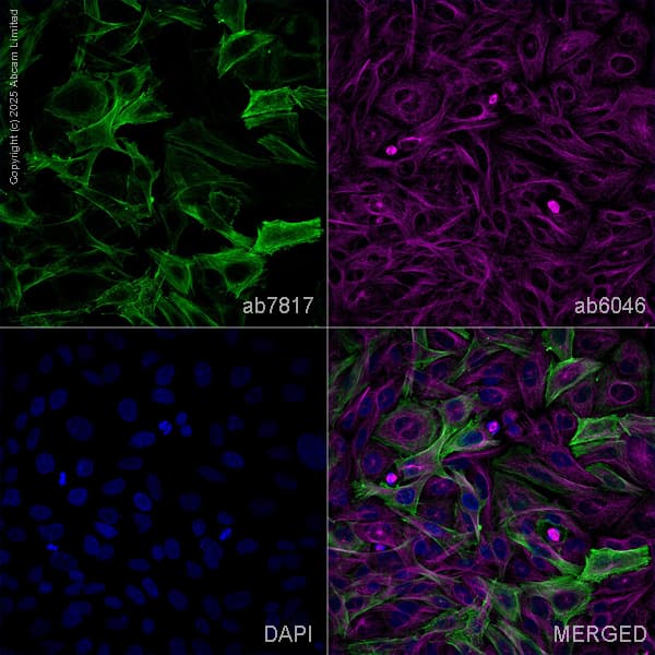 Anti-alpha smooth muscle Actin antibody [1A4] - BSA and Azide free(AB240654)