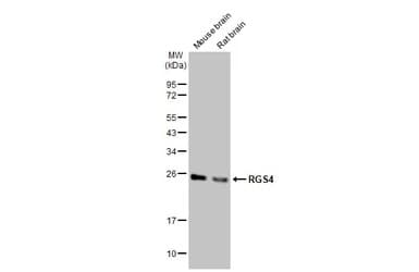 Rgs4 Antibody Hl1522 Ab308160  Western Blot Img407039