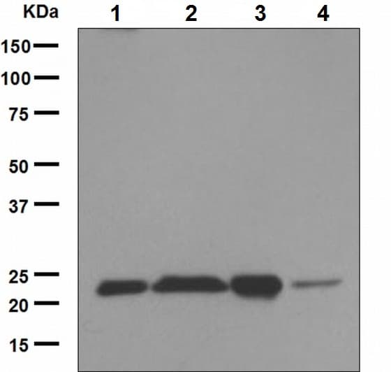 Peroxiredoxin 2 Prp Antibody Epr5155 Ab133481  Western Blot Img115648