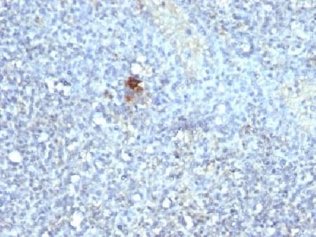 Tartrate Resistant Acid Phosphatase Antibody Acp5 1070 Bsa And Azide Free Ab212723  Immunohistochemistry Formalin Pfa Fixed Paraffin Embedded Sections Img136142