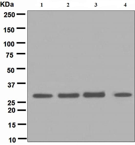 Dn 7 Antibody Epr5266 Bsa And Azide Free Ab248418  Western Blot Img116353