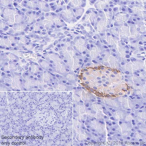 Anti-Glucagon antibody [EP3070](AB92517)