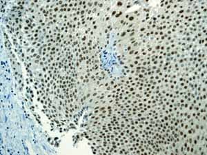 Sumo 1 Antibody Ep298 Bsa And Azide Free Ab248491  Immunohistochemistry Formalin Pfa Fixed Paraffin Embedded Sections Img107896