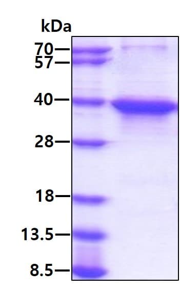 Recombinant Human MSI2 protein(AB167853)