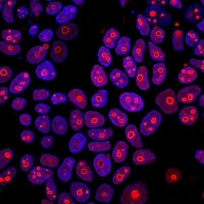 Cyclin B1 Antibody Ccnb1 1098 Ab212977  Immunocytochemistry Img59715