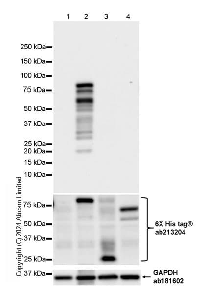Anti-TBR2 / Eomes antibody [RM2055](AB319166)