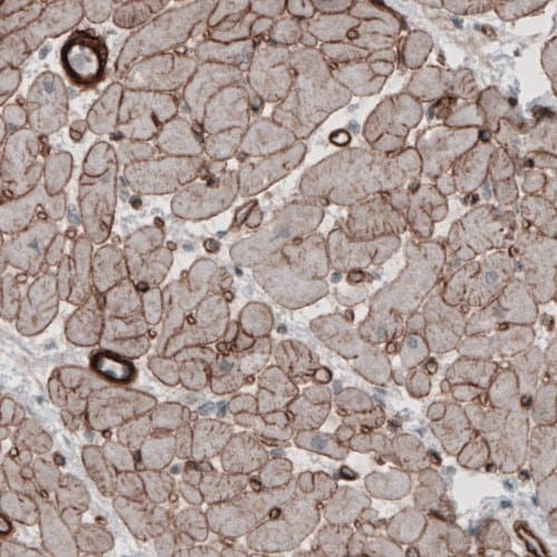 Anti-Laminin alpha 5/LAMA5 antibody [CL3118](AB210957)