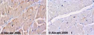 Anti-M6PR (cation independent) antibody(AB32815)
