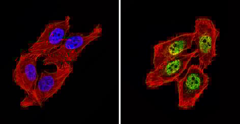 Anti-NCOR2/SMRT antibody(ab5802)
