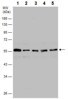 Anti-Calreticulin antibody(AB227444)