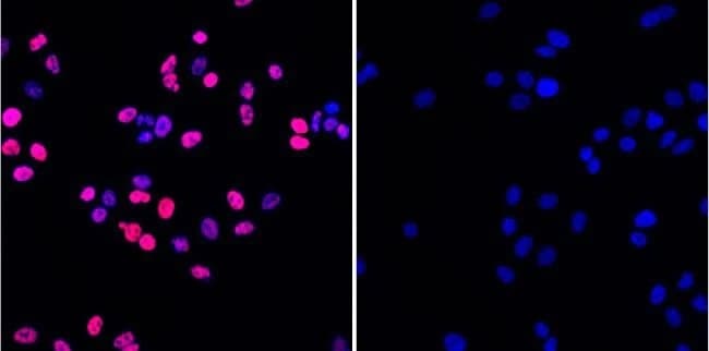Anti-gamma H2A.X (phospho S139) antibody [3F2](AB22551)