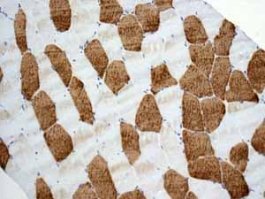 Anti-TNNC1 antibody [EPR9692(B)] - BSA and Azide free(AB248838)